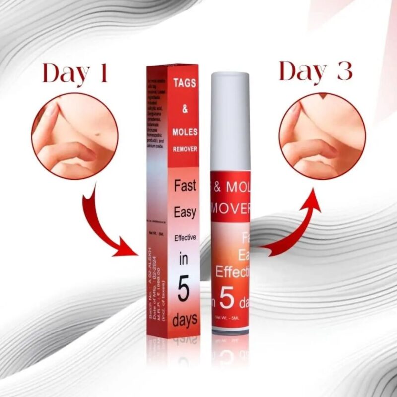 Tags & Moles Remover - Image 4