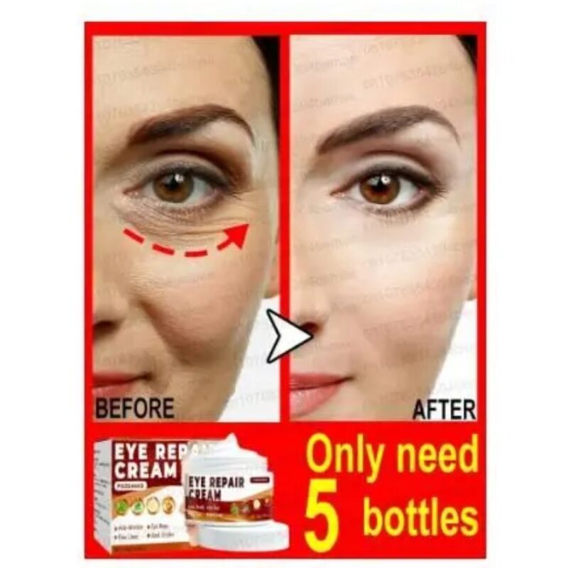 Eye Repair Cream (Pack of 2) - Image 3