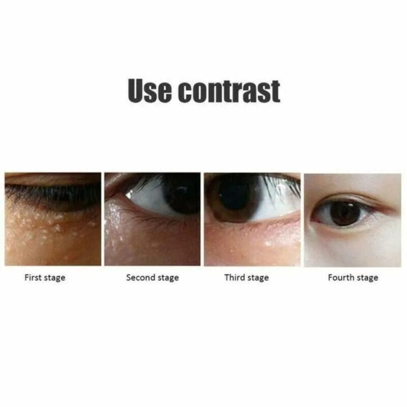 Remove Dark Circles Wrinkles Eye Bags - Image 2