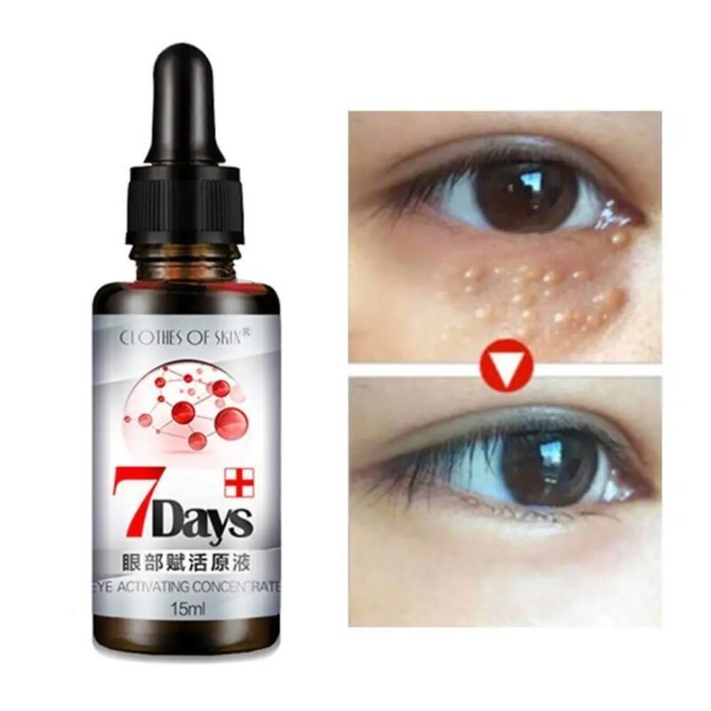 Remove Dark Circles Wrinkles Eye Bags