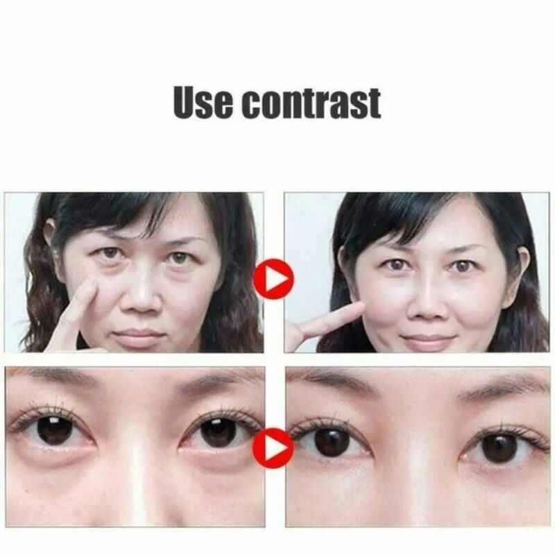 Remove Dark Circles Wrinkles Eye Bags - Image 5