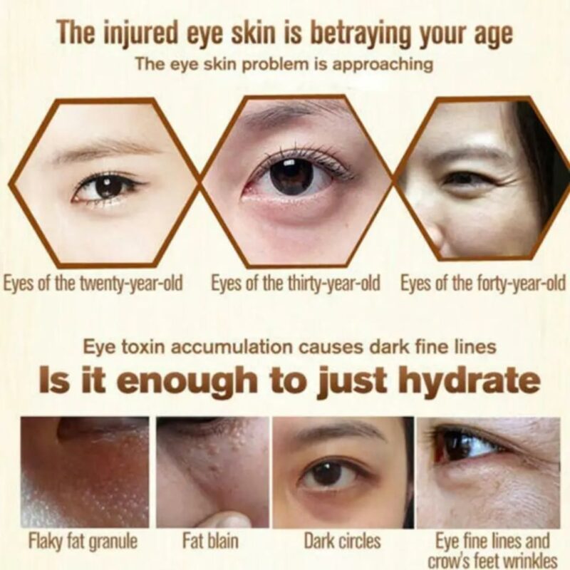 Remove Dark Circles Wrinkles Eye Bags - Image 3