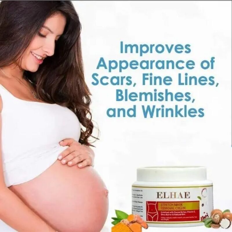 Stretch Mark Removal Cream - Image 4