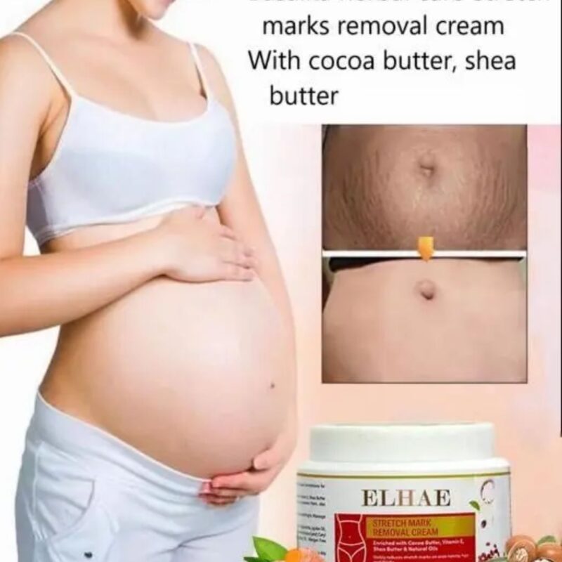 Stretch Mark Removal Cream - Image 3