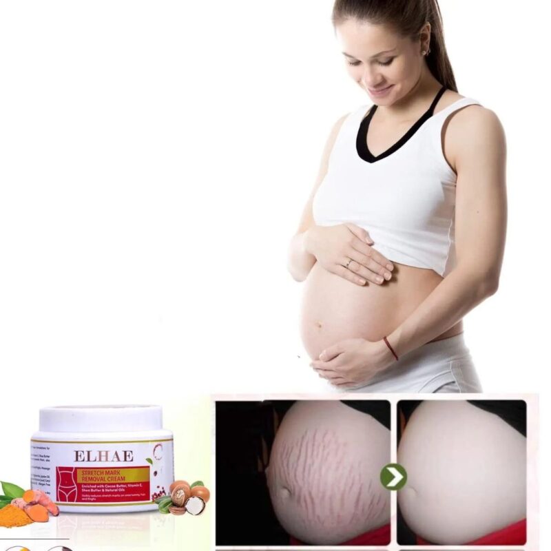 Stretch Mark Removal Cream - Image 2